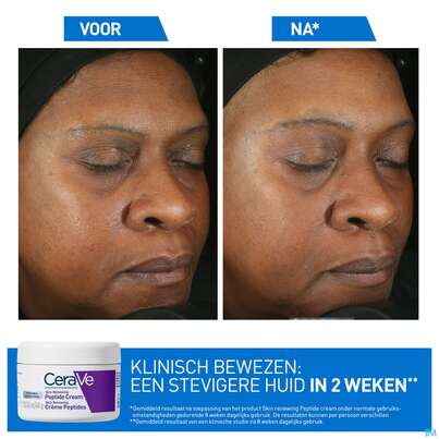 Cerave Skin Renewing Peptide Cr 48ml, A-Nr.: 5985696 - 06