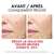 Sie sehen eine Packung Vichy Liftactiv B3 Anti-pigmentflecken Creme Lsf50 50ml, Produktbild: 24 Vichy Liftactiv B3 Anti-pigmentflecken Creme Lsf50 50ml, A-Nr.: 5662504 - 24